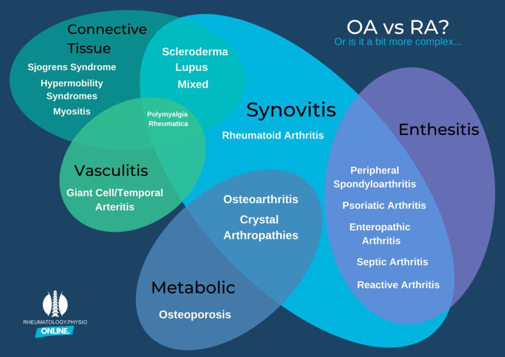 OA vs RA Rheumatology Physio